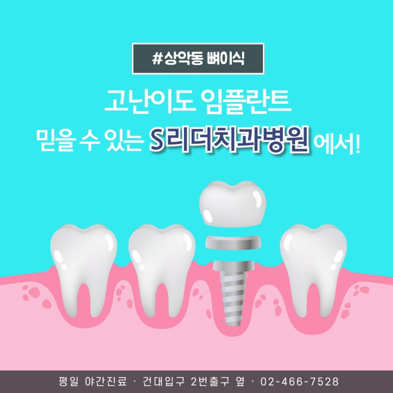 화양동치과 무치악임플란트 보철식립방안 2가지에 대해서 관련 이미지 6