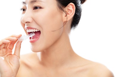 Gwangjin-gu Dental Clinic Orthodontics: How Should I Choose the Right Method for Me? image 6