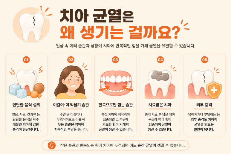 송정동치과, 씹을 때만 치아가 찌릿하다면 치아 균열 때문일까요? 관련 이미지 3
