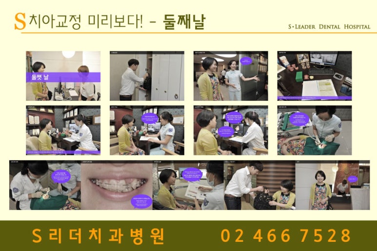건대치아교정치과 수준높은 치아교정이 되려면 관련 이미지 9