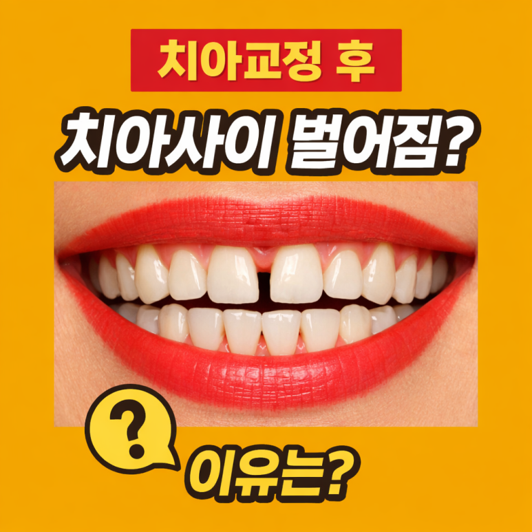 Why Do Teeth Feel Like They’re Spacing Out After Orthodontic Treatment at Nowon Station Dental Clinic? image 1