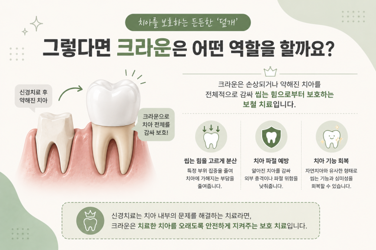 자양동치과, 신경치료를 했는데 왜 크라운까지 해야 할까요? 관련 이미지 4