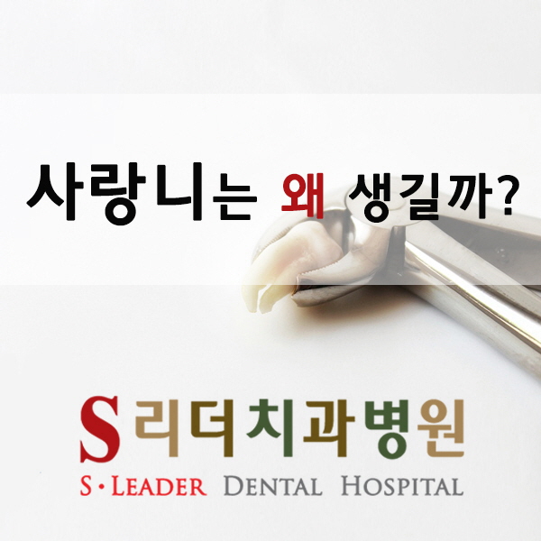 화양동치과 사랑니 도대체 왜생기나요? 관련 이미지 1