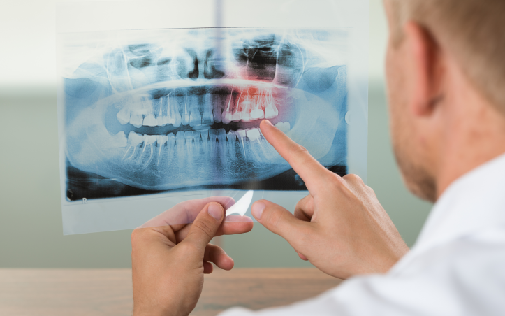 3 Things to Check When Considering Implants at Sagajeong Dental Clinic image 3