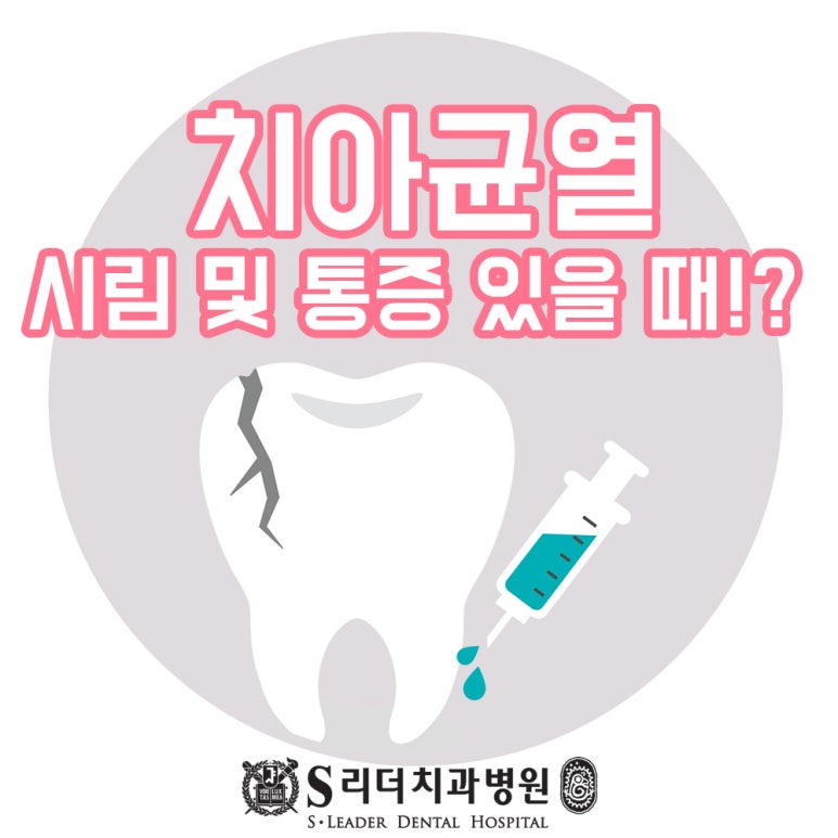 중곡동치과 치아균열증후군 씹을때 통증 있다면 관련 이미지 1