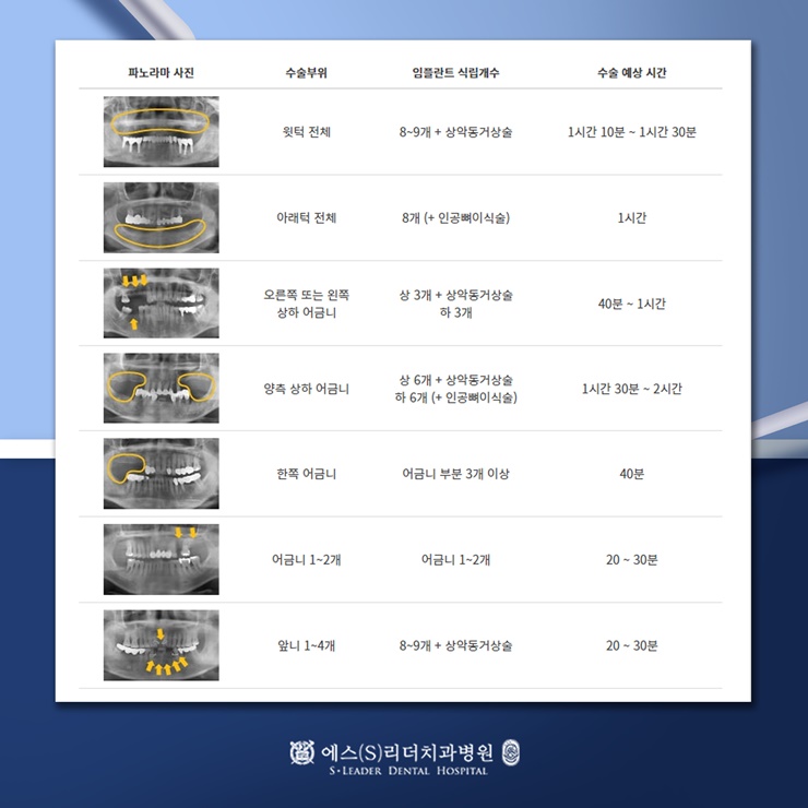 사가정역치과 임플란트를 앞두고 계시다면 관련 이미지 9