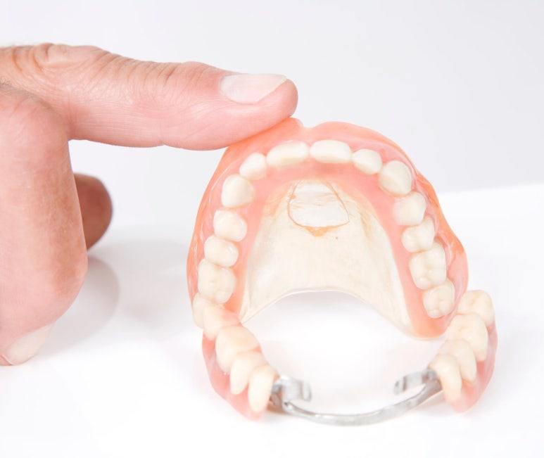 Janghanpyeong Station Dental Clinic: Which Treatment Is More Suitable, Implants or Dentures? image 6
