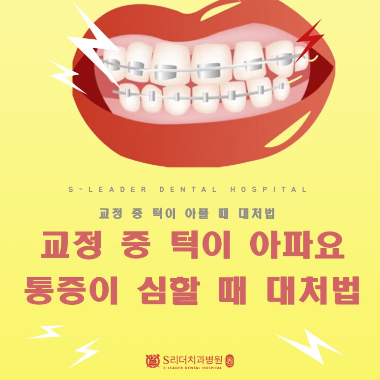 Yongmasan Station Dental Clinic: My Jaw Hurts During Orthodontic Treatment! What Should I Do When Orthodontic Pain Is Severe? image 1
