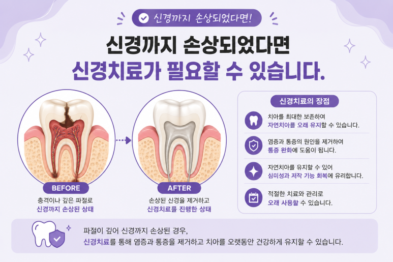 군자동치과 앞니 여러 개가 동시에 깨졌다면? 치아마다 치료 방법이 다른 이유 관련 이미지 6