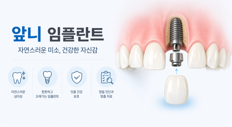 Guwi-dong Dental Clinic 2030 Front Tooth Implants: A Complete Summary of the Must-Know Checkpoints image 2