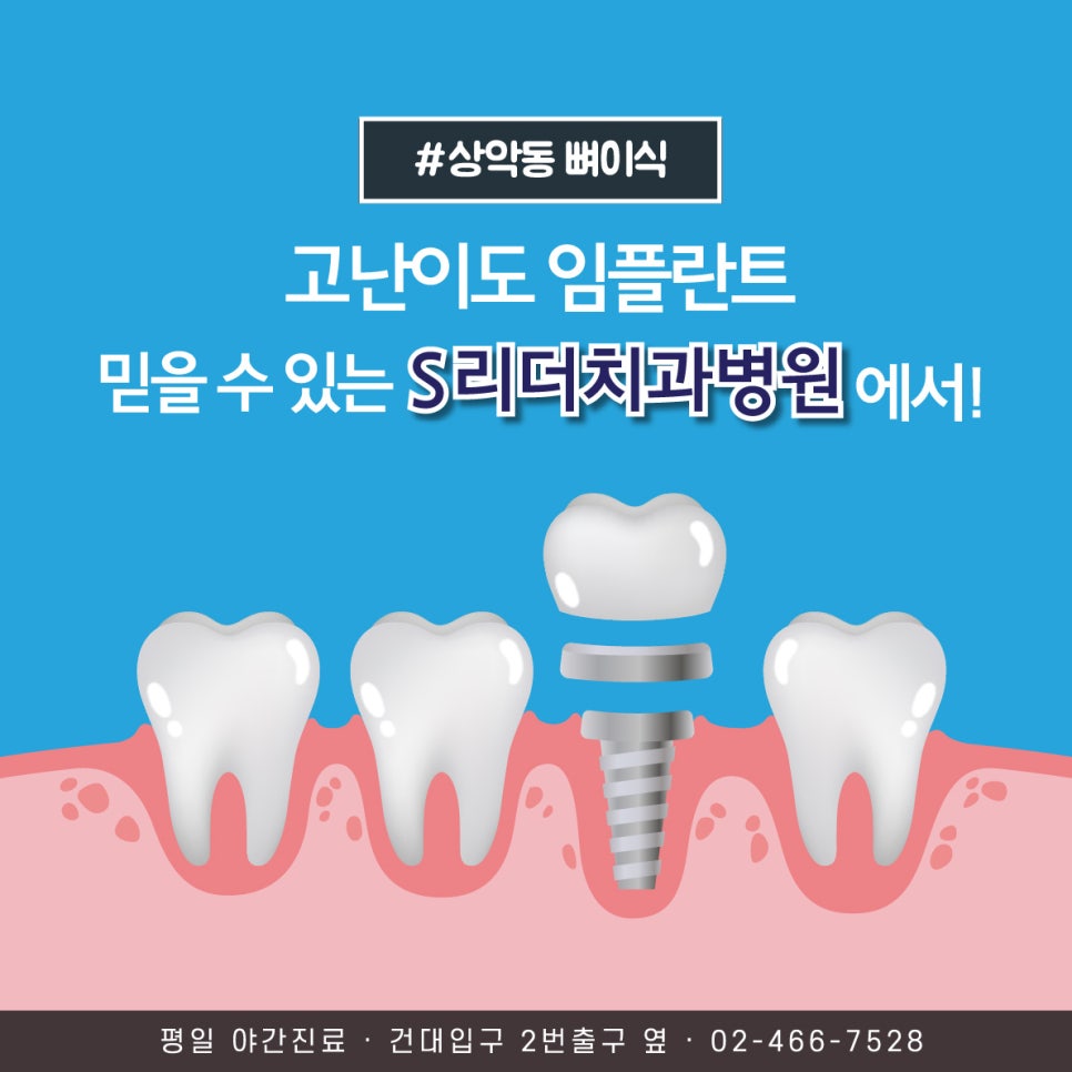 성수역치과 노인임플란트가 의료보험적용이 가능한 경우는 관련 이미지 3