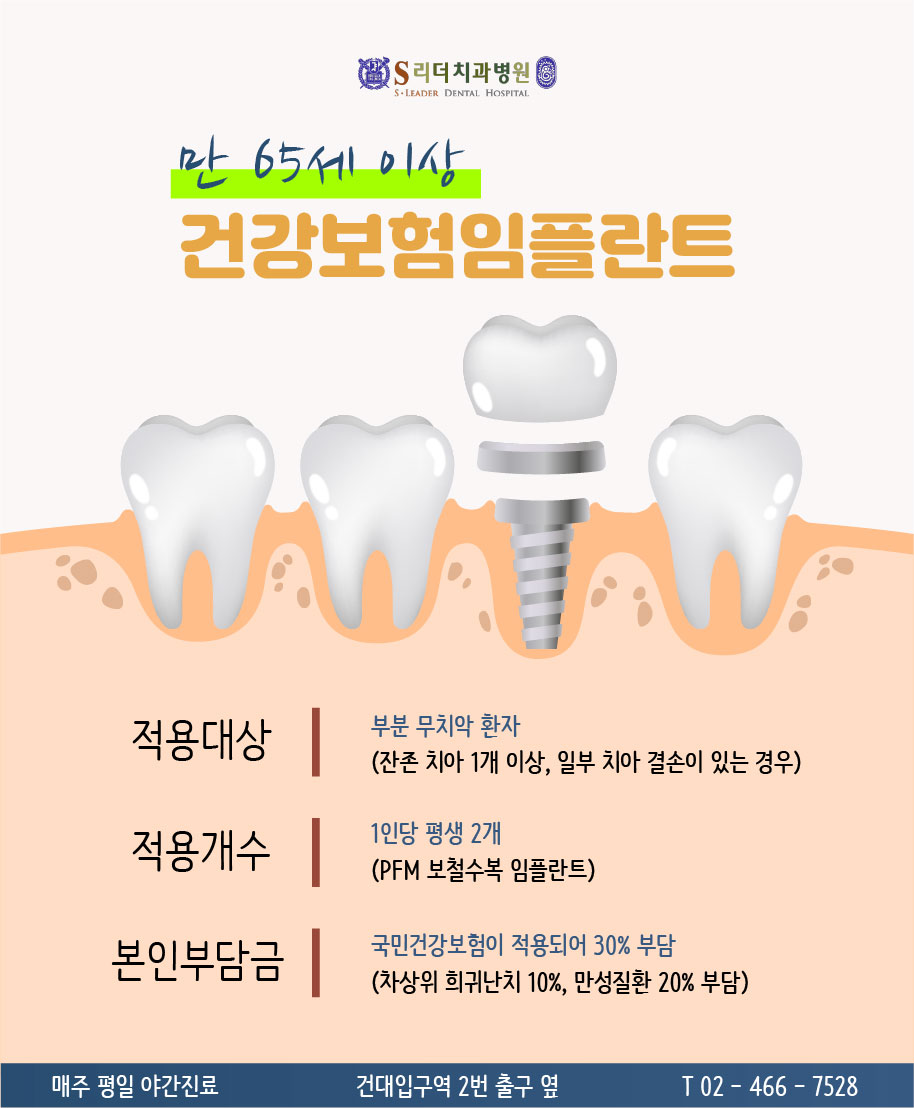 건대치과 노인임플란트 되는 경우가 궁금하다면 관련 이미지 3