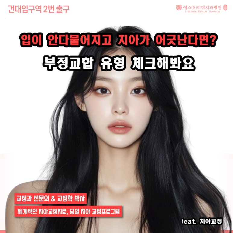 [Recommended Seoul Orthodontic Clinic] If Your Mouth Doesn’t Close Properly and Your Teeth Are Misaligned: Check the Types of Malocclusion image 1