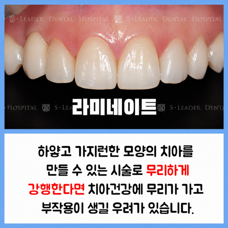 앞니 라인 하나로 달라지는 첫인상, 노원역치과에서 알려드립니다 관련 이미지 5