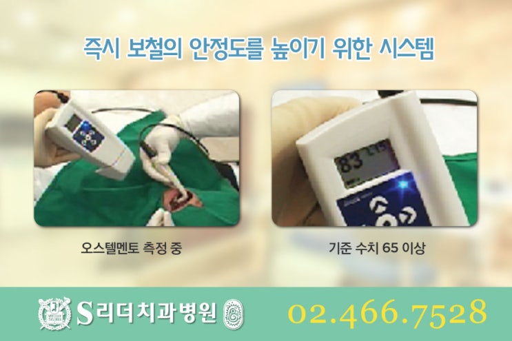 건대당일임플란트 잘하기위한 필수요소 관련 이미지 5