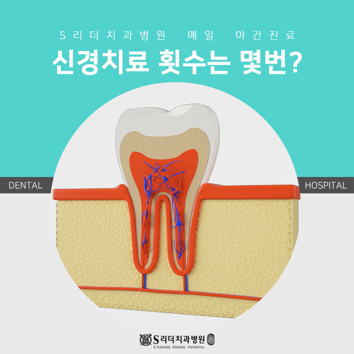 건대 신경치료 횟수 몇번 필요할까요? 관련 이미지 1