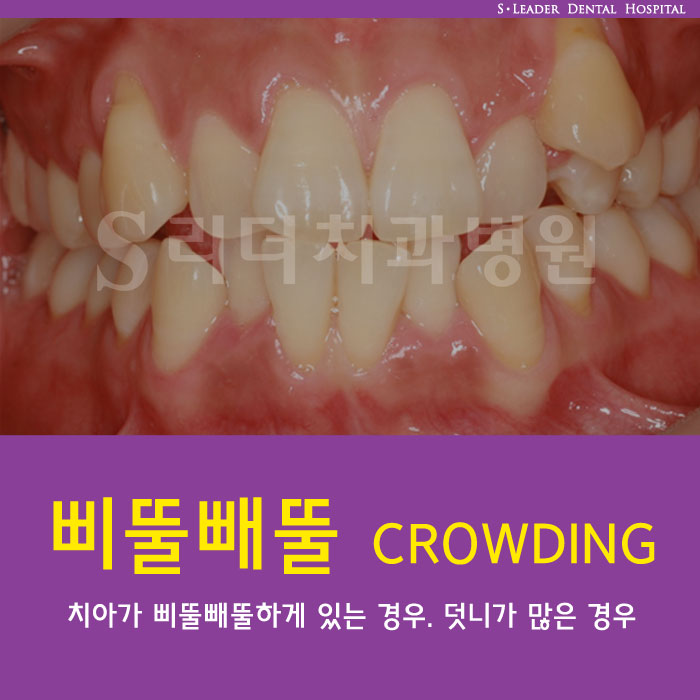 건대교정치과 내 마음에 쏙 드는 교정치과 어때요? 관련 이미지 3