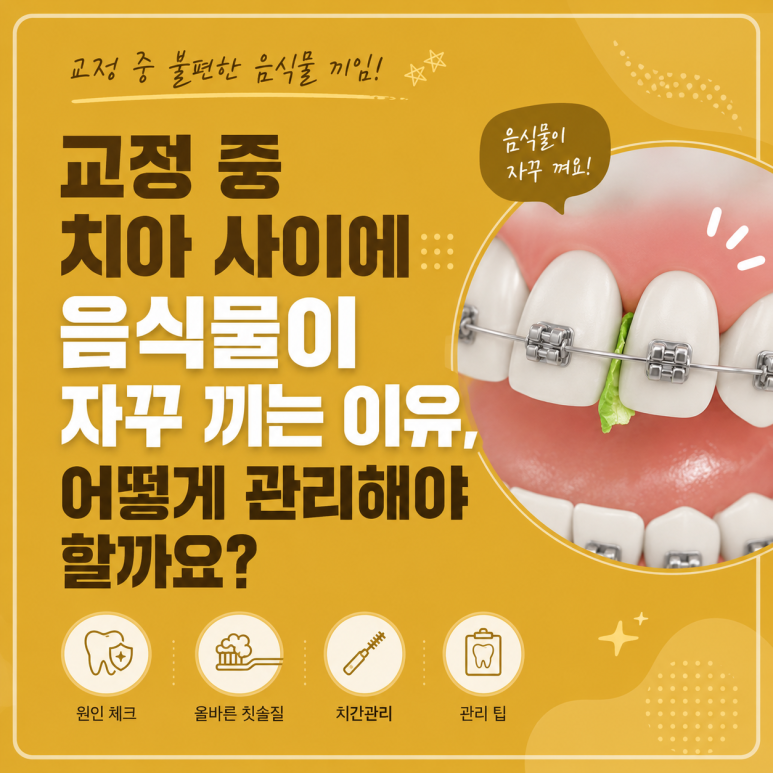 Mangu-dong Dental Clinic: Why Food Keeps Getting Stuck Between Your Teeth During Orthodontic Treatment and How to Manage It image 1