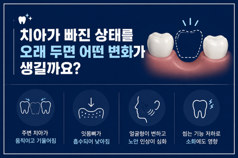 서울임플란트잘하는치과, 치아 하나 빠졌을 때 방치하면 생기는 변화 관련 이미지 3