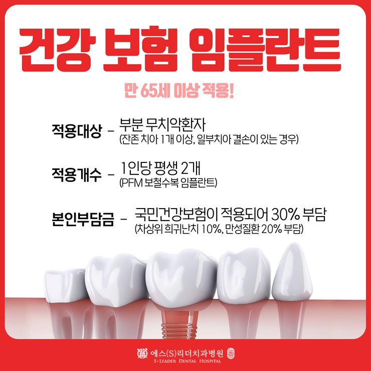 초고령화 시대 치과에서 받을 수 있는 혜택 65세 이상 서울노인치과를 잘 고를려면? 관련 이미지 17