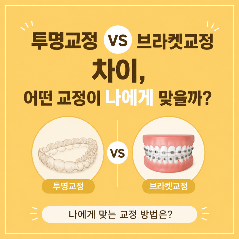 건대교정치과 투명교정과 브라켓교정 차이, 어떻게 다를까요? 관련 이미지 1
