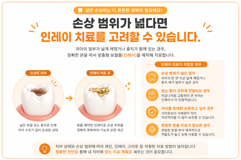 Dongdaemun-gu Dental Clinic: If a Tooth Is Chipped, Which Treatment Is Needed—Resin or Inlay? image 4