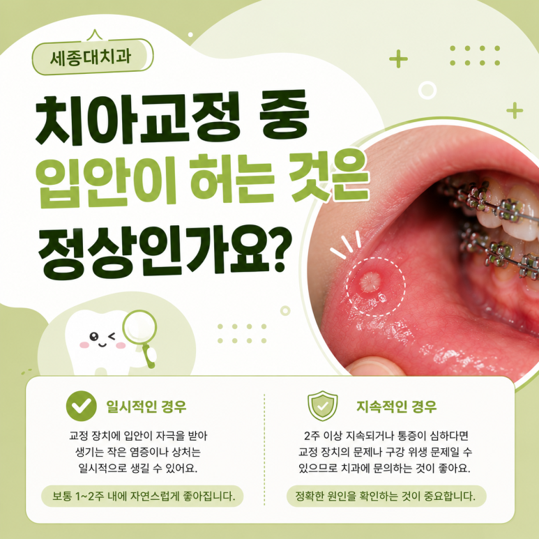 세종대치과, 치아교정 중 입안이 자꾸 헐어요. 왜 그럴까요? 관련 이미지 3