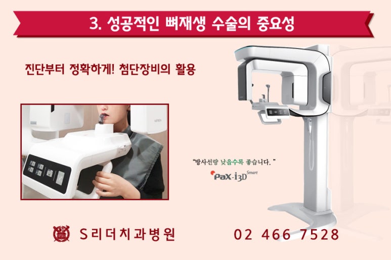 건대치과 성공적인 임플란트를 위한 포인트! 관련 이미지 6