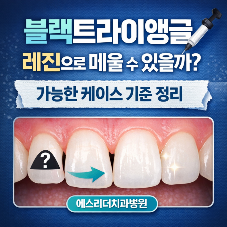 광진구치과 블랙트라이앵글 레진 치료, 가능한 경우와 판단 기준 관련 이미지 1