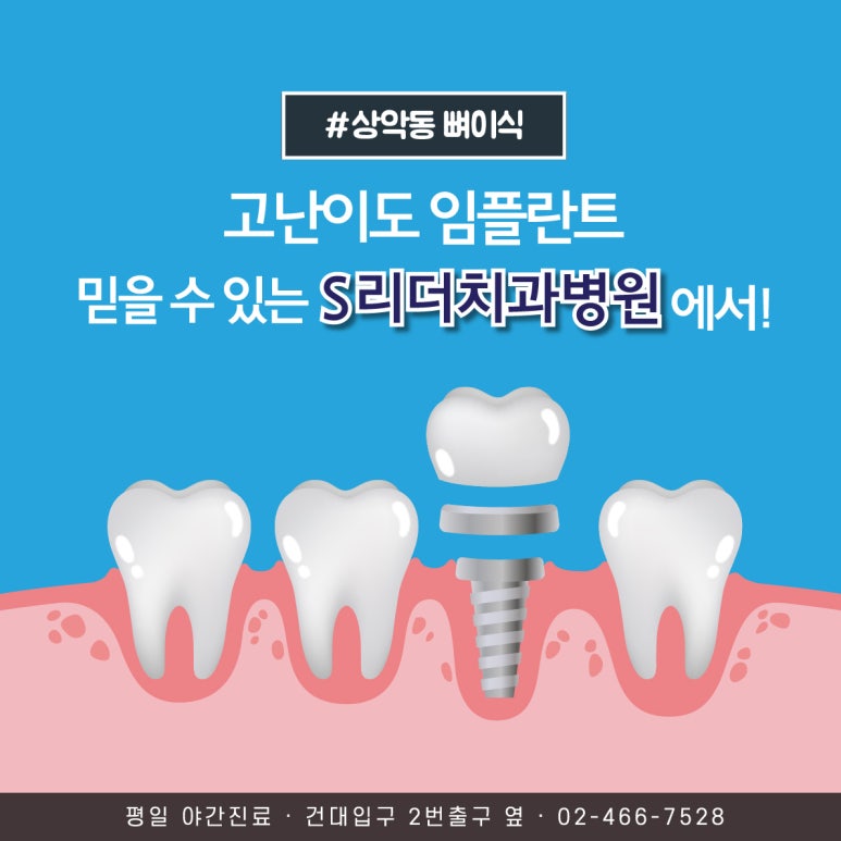 광장동치과, 뼈이식 꼭 해야 하나요? 임플란트 뼈이식이 필요한 경우 관련 이미지 8