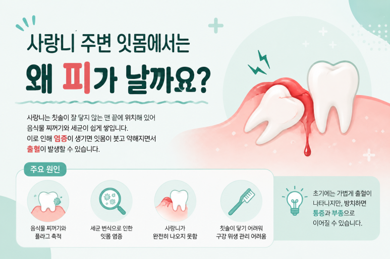 강변역치과 사랑니 주변 잇몸에서 피가 난다면 염증 때문일까요? 관련 이미지 2