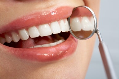 Why Does My Gums Feel Like They Have Receded After Orthodontic Treatment? | Seoul Dental Recommendation image 5