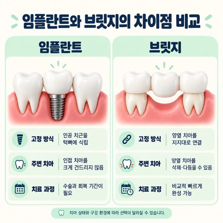 광진구임플란트와 브릿지 차이, 어떤 치료 방법이 나에게 맞을까? 관련 이미지 3