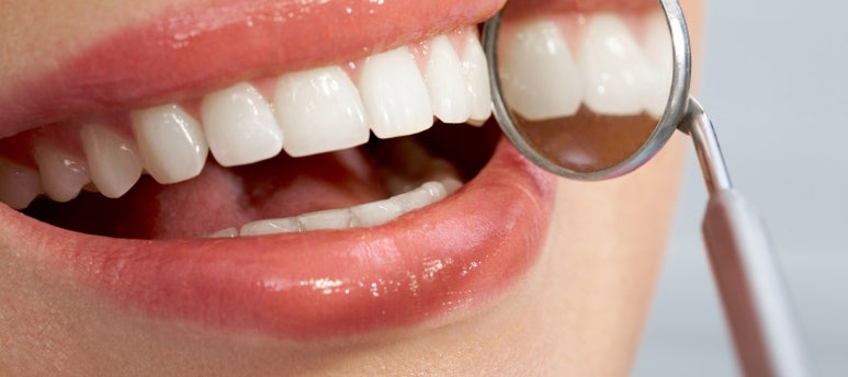 Seongsu-dong Dental Clinic: Why Is an Orthodontic Retainer Important? image 2