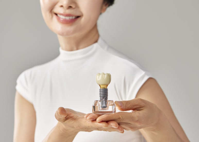 [Junggok-dong Implant] For diabetic patients worried about slow recovery, is implant treatment possible? image 2