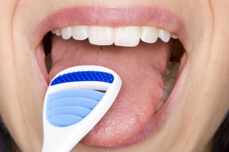 5 Dental Causes of Halitosis (Bad Breath) Explained by Sagajeong Station Dental Clinic image 5