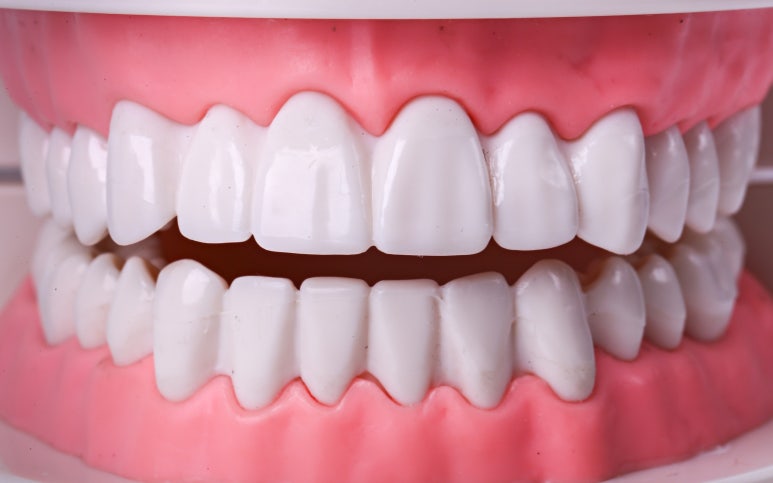 Seoul Dental Clinic Recommendation: If Your Orthodontics Shifted Again... Do You Really Need Retreatment? image 5