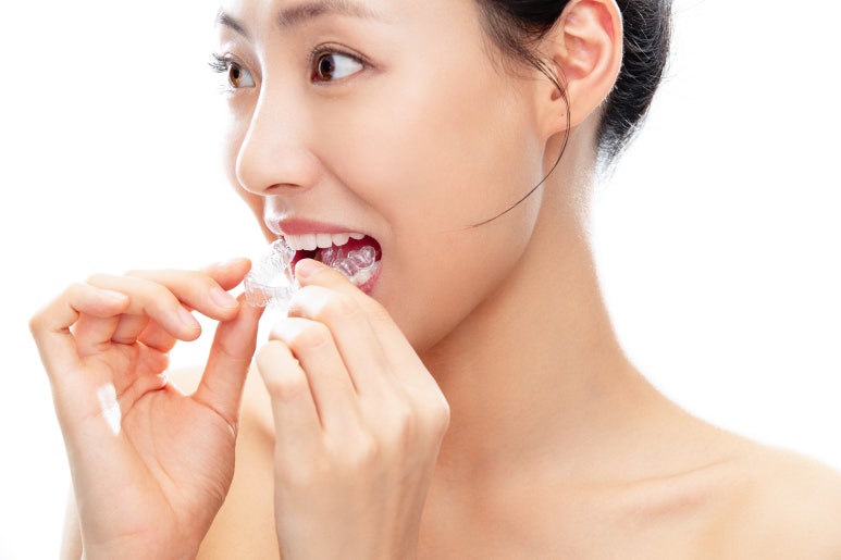 Seoul Night Dental | Clear Aligners vs. Traditional Braces: Which Is Right for Me? From Differences to Selection Criteria image 3