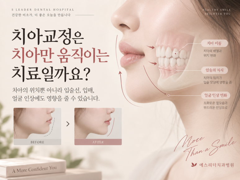 건대교정치과, 교정하면 얼굴형이 정말 달라질까요? 관련 이미지 2