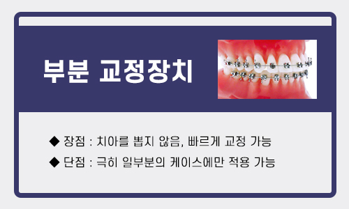 건대입구교정치과 각 교정장치의 장단점 관련 이미지 5