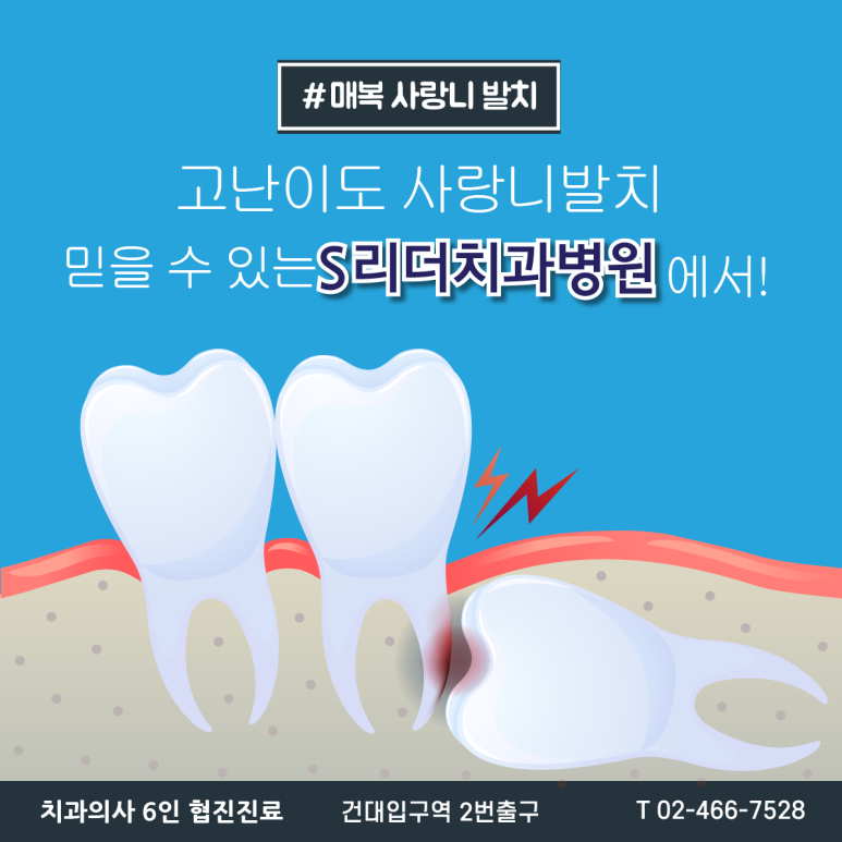 구의동치과 매복 사랑니를 오래 방치하면 어떤 문제가 생길까요? 관련 이미지 8