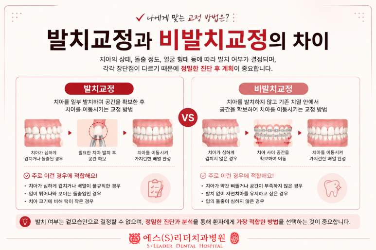 군자동치과 치아교정 기간은 왜 사람마다 다를까요? 관련 이미지 4