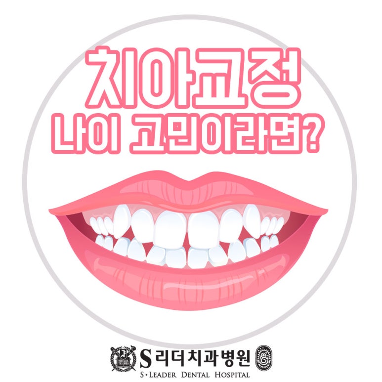 서울치아교정 나이를 놓고 고민이라면 관련 이미지 3