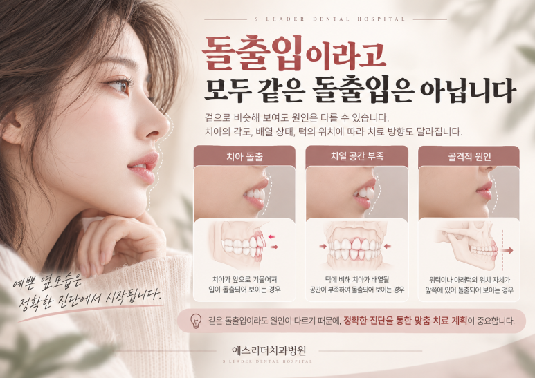 건대입구역치과, 돌출입 교정은 꼭 발치를 해야 할까요? 관련 이미지 2