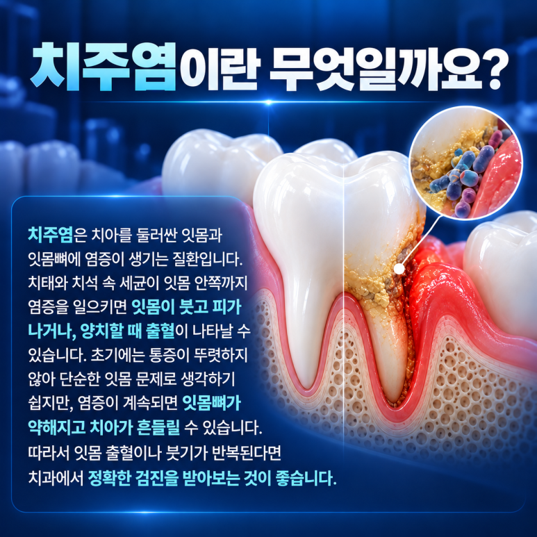 송정동치과 치주염 초기 증상, 놓치기 쉬운 신호 알아보기 관련 이미지 2