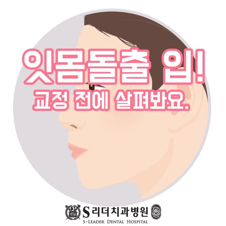 광진구치아교정 잇몸돌출 입이 나와 보인다면 관련 이미지 1