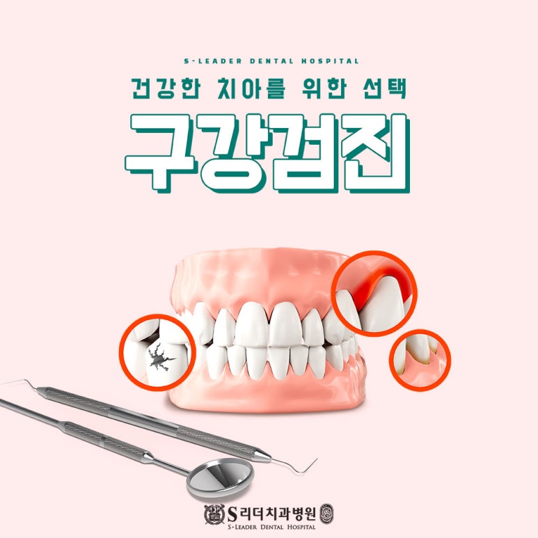 자양동치과 잇몸퇴축으로 치아시림 있다면 관련 이미지 17