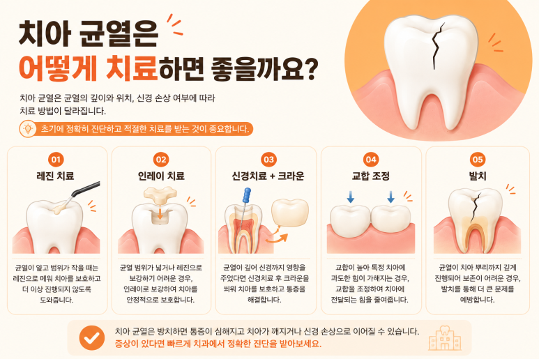 송정동치과, 씹을 때만 치아가 찌릿하다면 치아 균열 때문일까요? 관련 이미지 7