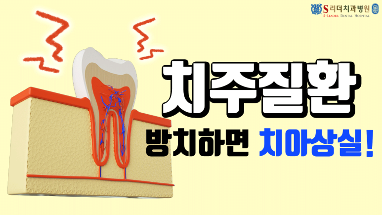 상봉동치과에서 자주 보는 치과 질환들, 왜 정기 검진이 중요한지 알려드립니다 관련 이미지 4