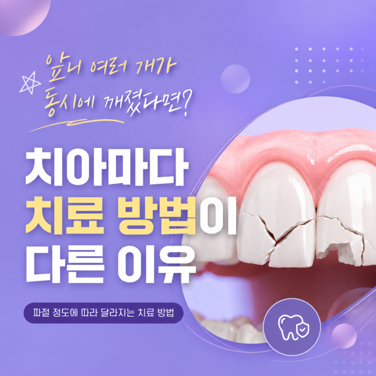 군자동치과 앞니 여러 개가 동시에 깨졌다면? 치아마다 치료 방법이 다른 이유 관련 이미지 1